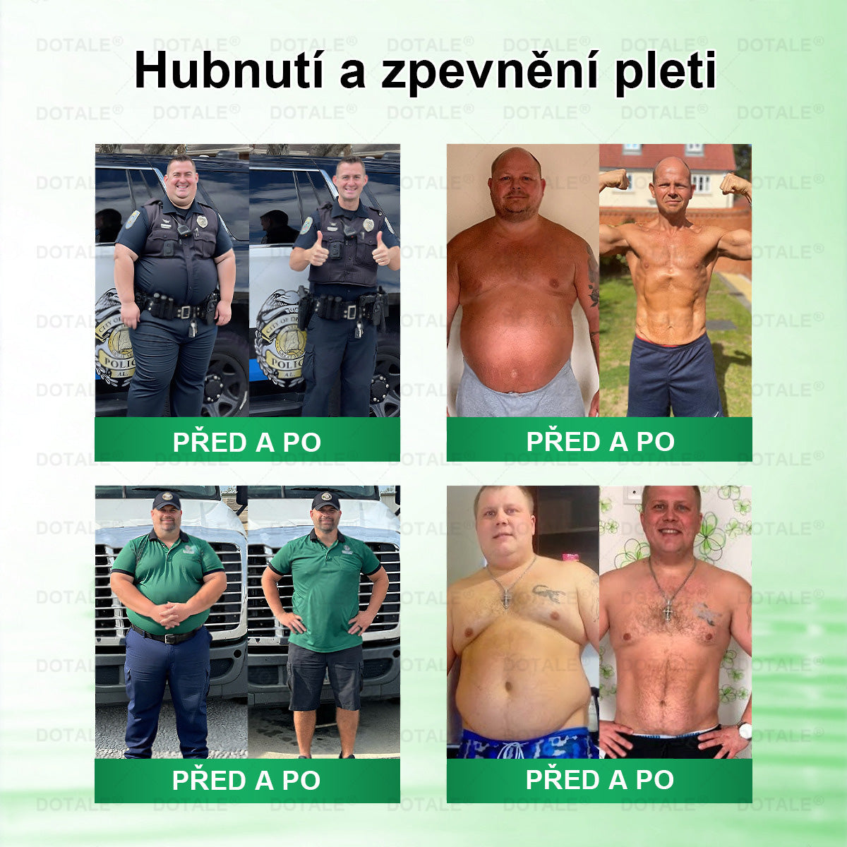 𝑫𝑶𝑻𝑨𝑳𝑬® metabolická nano mikrojehličková náplast 🎁 (Pouze jednou denně, viditelné výsledky již do 7 dnů!) ✅ Formule Berberin + Moringa, ideální při nadváze, nedokonalostech pokožky, diabetu, spánkové apnoe a kloubních potížích 💥💥