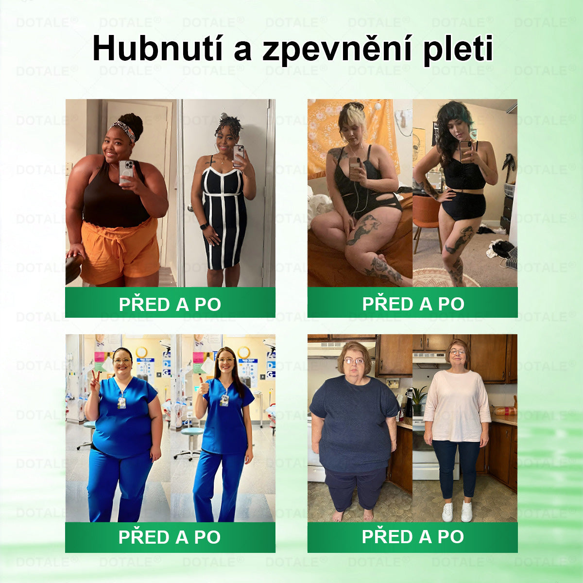 𝑫𝑶𝑻𝑨𝑳𝑬® metabolická nano mikrojehličková náplast 🎁 (Pouze jednou denně, viditelné výsledky již do 7 dnů!) ✅ Formule Berberin + Moringa, ideální při nadváze, nedokonalostech pokožky, diabetu, spánkové apnoe a kloubních potížích 💥💥