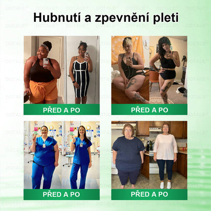 𝑫𝑶𝑻𝑨𝑳𝑬® metabolická nano mikrojehličková náplast 🎁 (Pouze jednou denně, viditelné výsledky již do 7 dnů!) ✅ Formule Berberin + Moringa, ideální při nadváze, nedokonalostech pokožky, diabetu, spánkové apnoe a kloubních potížích 💥💥