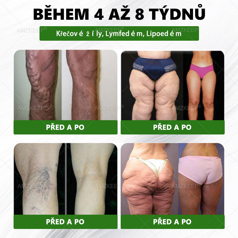 🇨🇿Lékařem formulovaný AMZKEEP® Moringa Berberin × NAD+ 10-in-1 Pokročilá Nano Mikroneedle Náplast (Zažijte viditelné výsledky již za 7 dní)