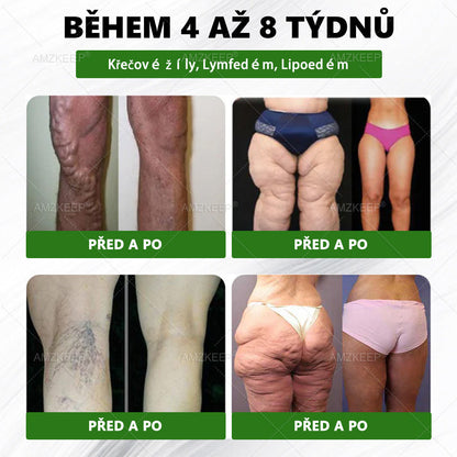 🇨🇿Lékařem formulovaný AMZKEEP® Moringa Berberin × NAD+ 10-in-1 Pokročilá Nano Mikroneedle Náplast (Zažijte viditelné výsledky již za 7 dní)